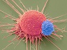 web_C0226482-T_lymphocyte_and_cancer_cell,_SEM-SPL